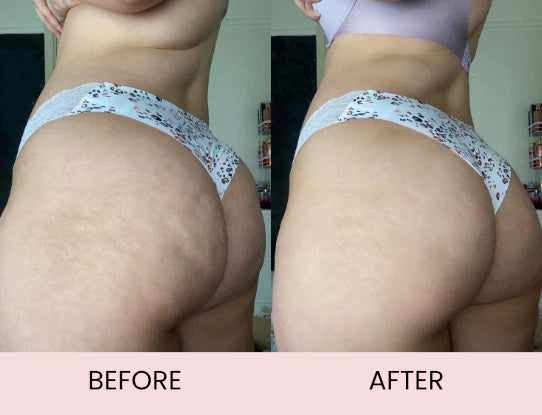 Anti Cellulite Massage Oil