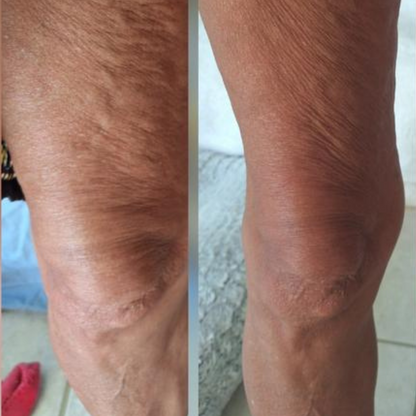 Anti Cellulite Massage Oil